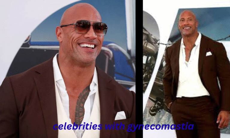 celebrities with gynecomastia​